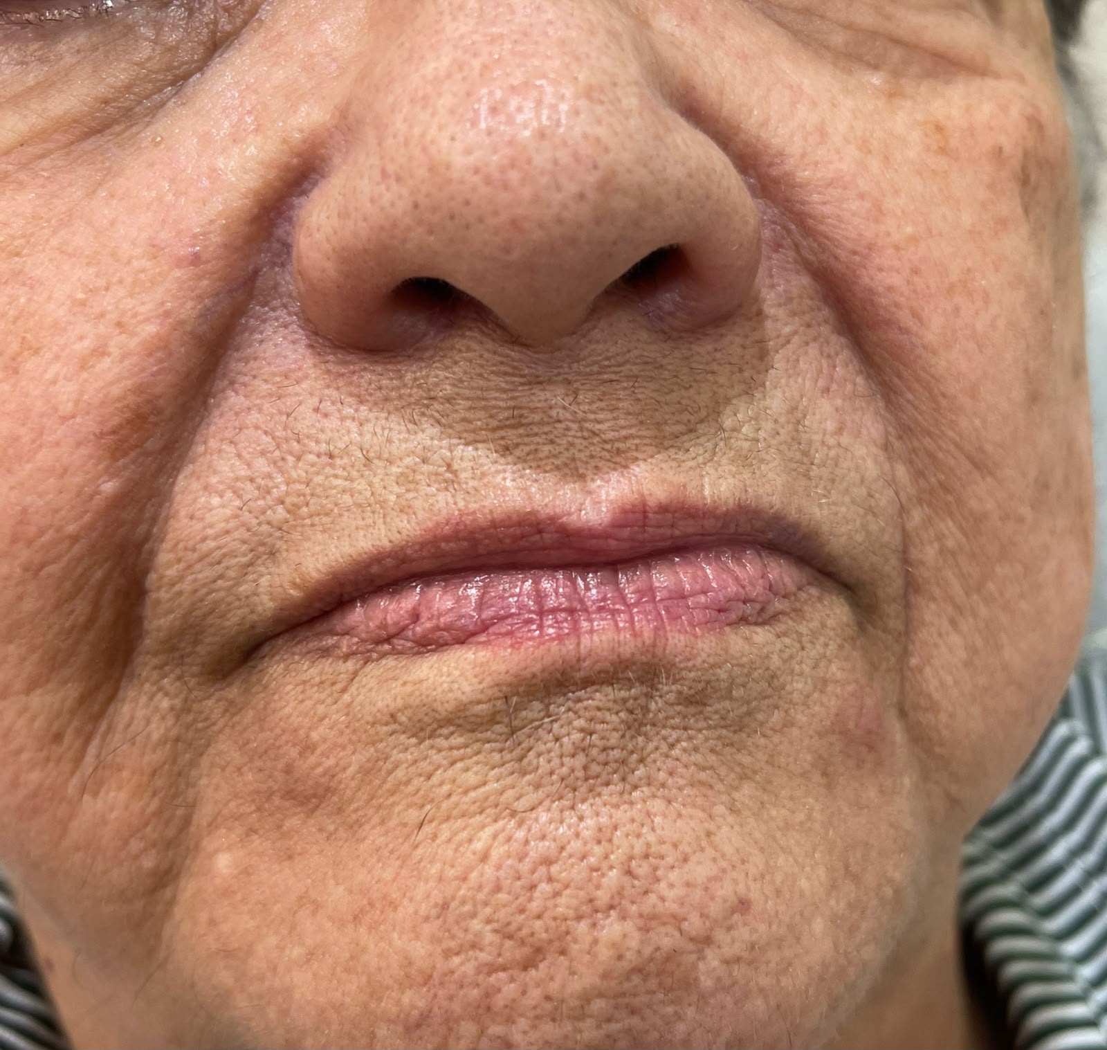 Registro labial frontal. — composição clínica original enviada pela doutora